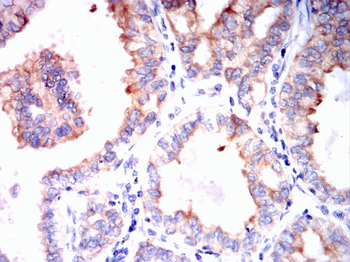 MUC1 Antibody