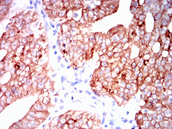 MUC1 Antibody