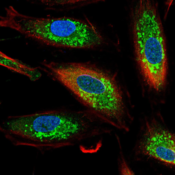 TH Antibody