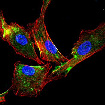WFDC2 Antibody