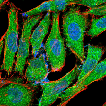 TXNIP Antibody
