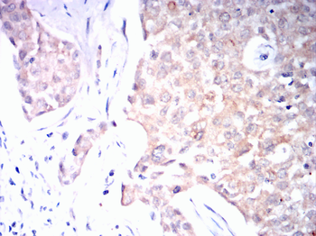 TXNIP Antibody