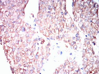 TXNIP Antibody