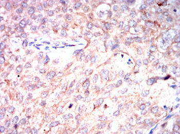 CTSD Antibody