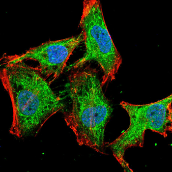 DPP4 Antibody