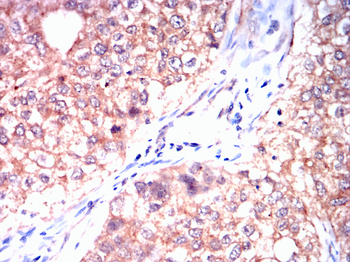 PDCD6IP Antibody