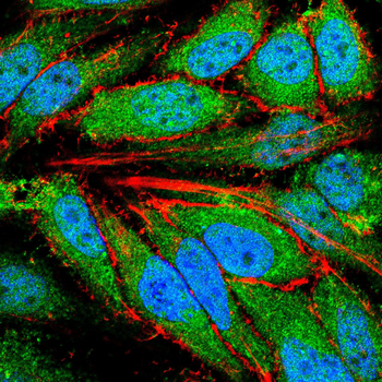FOS Antibody