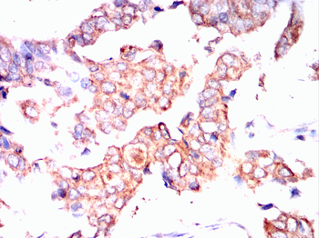 FOS Antibody