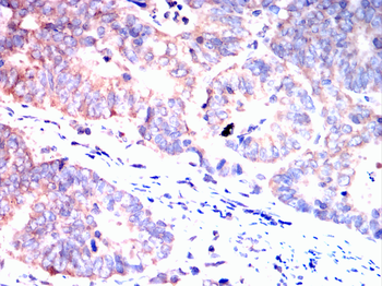 FOS Antibody