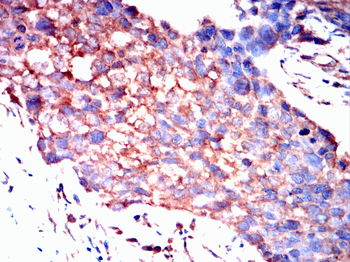 FOS Antibody