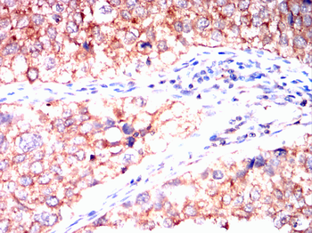 FOS Antibody