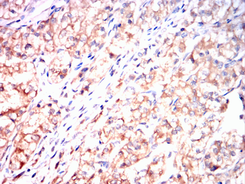 FOS Antibody