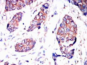 CD38 Antibody