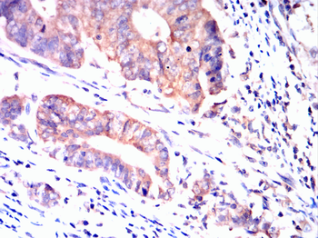 CD38 Antibody