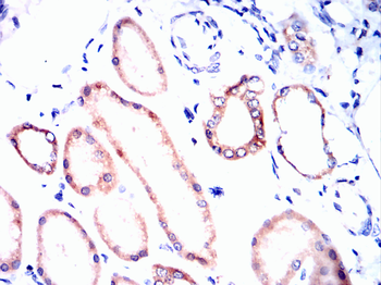 CD38 Antibody