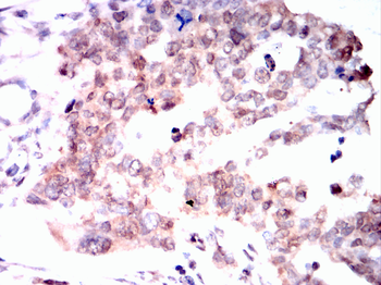 RB1 Antibody