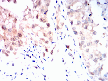 RB1 Antibody