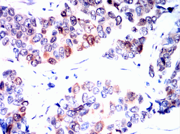 RB1 Antibody
