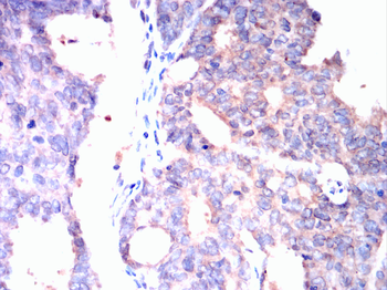 RB1 Antibody