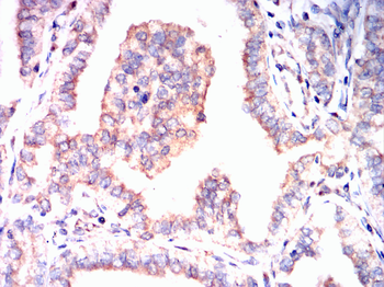 TNFAIP3 Antibody