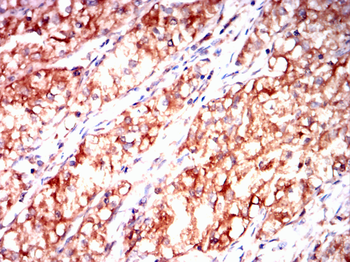 TNFAIP3 Antibody