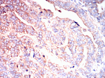 TNFAIP3 Antibody