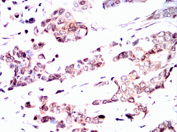 CEBPB Antibody