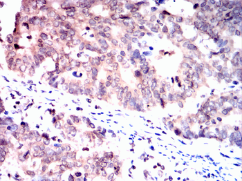 CEBPB Antibody