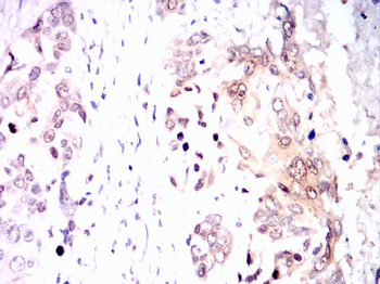 CEBPB Antibody