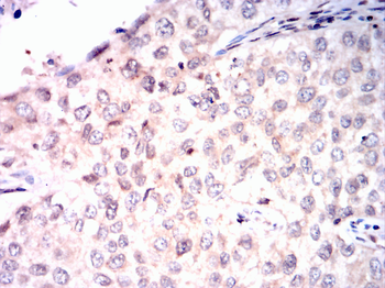 CEBPB Antibody