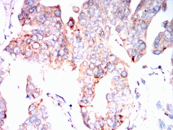 SOD2 Antibody