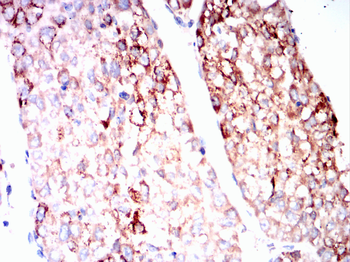 SOD2 Antibody