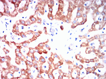 SOD2 Antibody
