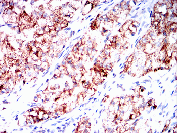 SOD2 Antibody