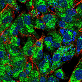 MAP1LC3B Antibody