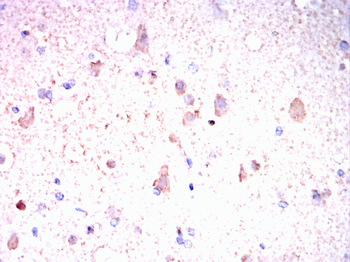 ENO2 Antibody