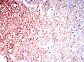 ENO2 Antibody