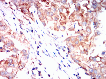 BRAF Antibody