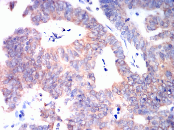BRAF Antibody