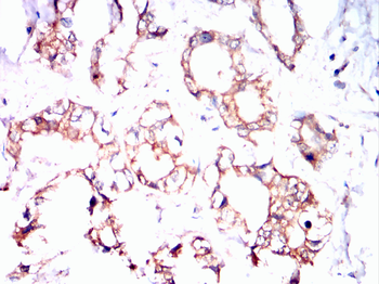 BRAF Antibody