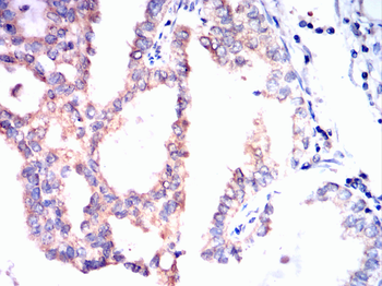 BRAF Antibody