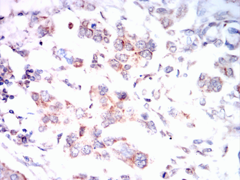 DLG4 Antibody