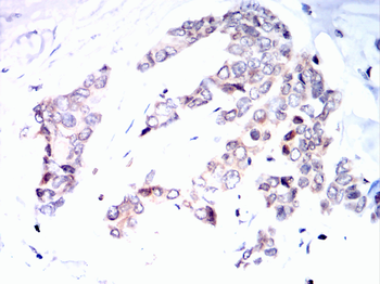 HSPA8 Antibody