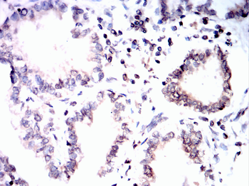 HSPA8 Antibody