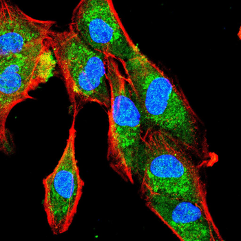 TARDBP Antibody