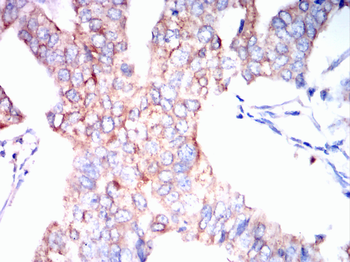 CDK6 Antibody