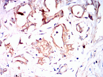 CDK6 Antibody