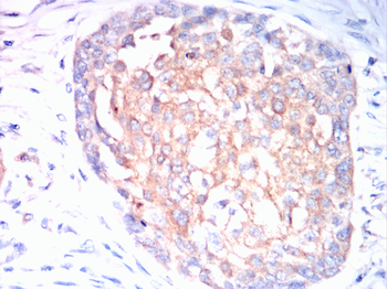 CDK6 Antibody