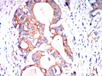 CDK6 Antibody