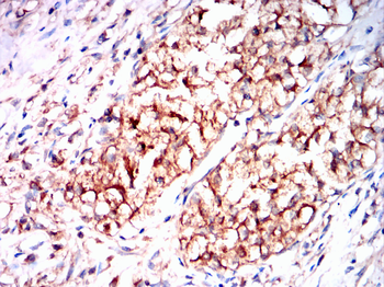 CDK6 Antibody